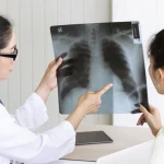 Foto Thorax PA yang Ideal: Sekadar Gambar, atau Penentu Diagnosis?
